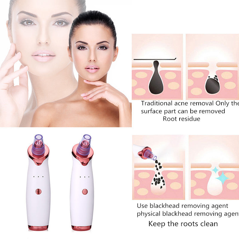 Skincare Blackhead Removal Kit - Great for Multiple Uses!